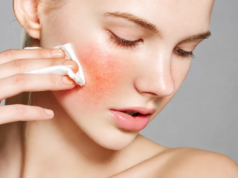 Kết hợp quá nhiều hoạt chất tẩy da chết có thể làm suy yếu hàng rào bảo vệ da.